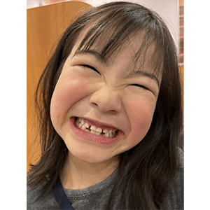 歯が抜けたよ。少しずつおねえさんになっていくーーー