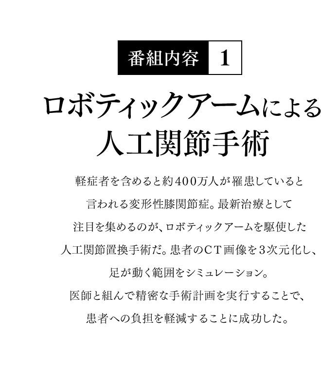 【番組内容-1】ロボティックアームによる人工関節手術 - 軽症者を含めると約400万人が罹患していると言われる変形性膝関節症。最新治療として注目を集めるのが、ロボティックアームを駆使した人工関節置換手術だ。患者のCT画像を３次元化し、足が動く範囲をシミュレーション。医師と組んで精密な手術計画を実行することで、患者への負担を軽減することに成功した。